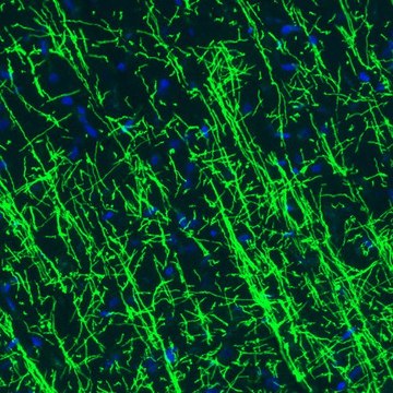 Monoclonal Anti-MBP antibody produced in mouse Prestige Antibodies&#174; Powered by Atlas Antibodies, clone CL2829, purified immunoglobulin, buffered aqueous glycerol solution