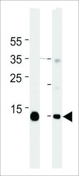 MONOCLONAL ANTI-MYOGLOBIN antibody produced in mouse clone 444CT19.2.1, IgG fraction of antiserum, buffered aqueous solution