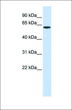 Anti-SPTLC1 antibody produced in rabbit affinity isolated antibody