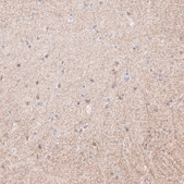 Anti-SYNPO antibody produced in rabbit Prestige Antibodies® Powered by Atlas Antibodies, affinity isolated antibody, buffered aqueous glycerol solution