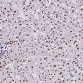 Anti-DUT antibody produced in rabbit Prestige Antibodies® Powered by Atlas Antibodies, affinity isolated antibody, buffered aqueous glycerol solution