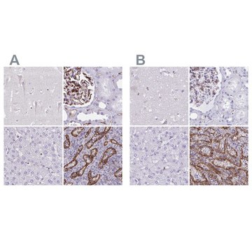 Anti-PITPNM3 antibody produced in rabbit Prestige Antibodies® Powered by Atlas Antibodies, affinity isolated antibody, buffered aqueous glycerol solution