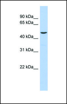 Anti-FLI1 antibody produced in rabbit affinity isolated antibody