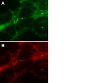 LentiBrite PSD95-GFP Lentiviral Biosensor