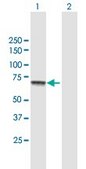 Anti-CPT2 antibody produced in mouse purified immunoglobulin, buffered aqueous solution