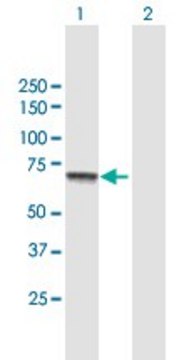 Anti-CPT2 antibody produced in mouse purified immunoglobulin, buffered aqueous solution