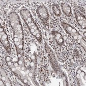 Anti-ATF5 antibody produced in rabbit Prestige Antibodies® Powered by Atlas Antibodies, affinity isolated antibody, buffered aqueous glycerol solution