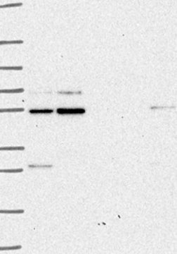 Anti-GLIS2 antibody produced in rabbit Prestige Antibodies&#174; Powered by Atlas Antibodies, affinity isolated antibody, buffered aqueous glycerol solution