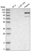 Anti-AMPD2 antibody produced in rabbit Prestige Antibodies® Powered by Atlas Antibodies, affinity isolated antibody, buffered aqueous glycerol solution