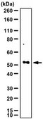 Anti-Matriptase-2/TMPRSS6 Antibody from rabbit, purified by affinity chromatography