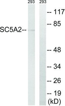 Anti-SLC5A2 antibody produced in rabbit affinity isolated antibody