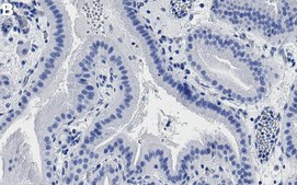 Anti-PTPN21 Antibody, clone 2K11 ZooMAb® Rabbit Monoclonal recombinant, expressed in HEK 293 cells