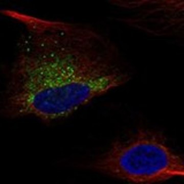 Anti-COL1A1 antibody produced in rabbit Prestige Antibodies&#174; Powered by Atlas Antibodies, affinity isolated antibody, buffered aqueous glycerol solution