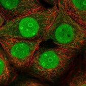 Anti-GON7 antibody produced in rabbit Prestige Antibodies® Powered by Atlas Antibodies, affinity isolated antibody, buffered aqueous glycerol solution