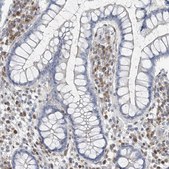 Anti-ZC3H12A antibody produced in rabbit Prestige Antibodies® Powered by Atlas Antibodies, affinity isolated antibody, buffered aqueous glycerol solution