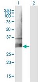 Anti-CLEC5A antibody produced in mouse IgG fraction of antiserum, buffered aqueous solution