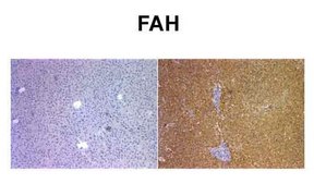 Anti-FAH IgG fraction of antiserum
