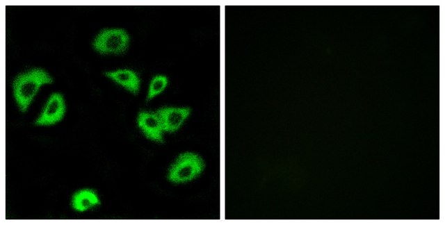 Anti-LILRB4 antibody produced in rabbit affinity isolated antibody