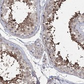 Anti-DPCD antibody produced in rabbit Prestige Antibodies® Powered by Atlas Antibodies, affinity isolated antibody, buffered aqueous glycerol solution