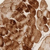 Anti-PABPC4 antibody produced in rabbit Prestige Antibodies® Powered by Atlas Antibodies, affinity isolated antibody, buffered aqueous glycerol solution