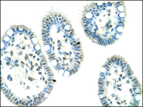 Anti-NR0B1 antibody produced in rabbit IgG fraction of antiserum