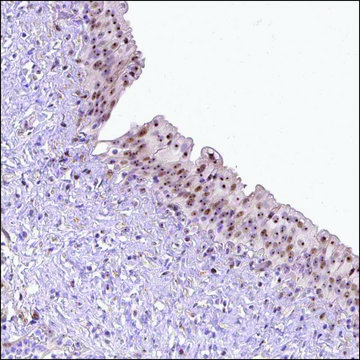 Anti-MXRA8 antibody produced in rabbit Prestige Antibodies&#174; Powered by Atlas Antibodies, affinity isolated antibody, buffered aqueous glycerol solution