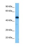 Anti-RIPK3 antibody produced in rabbit affinity isolated antibody