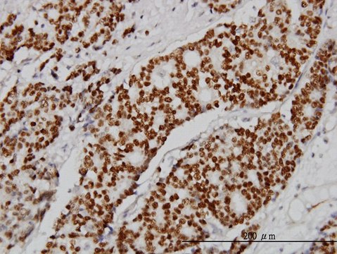 Monoclonal Anti-PGR antibody produced in mouse clone 5D10, purified immunoglobulin, buffered aqueous solution