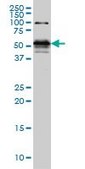 Monoclonal Anti-STK38 antibody produced in mouse clone 6G11, purified immunoglobulin, buffered aqueous solution