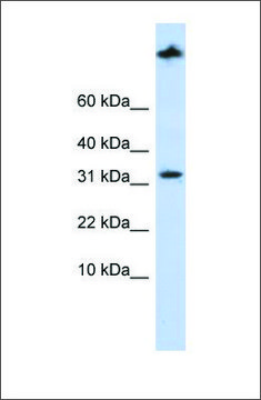 Anti-SCP2 antibody produced in rabbit affinity isolated antibody