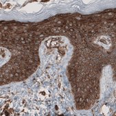 Monoclonal Anti-CARS antibody produced in mouse Prestige Antibodies® Powered by Atlas Antibodies, clone CL2304, purified immunoglobulin, buffered aqueous glycerol solution