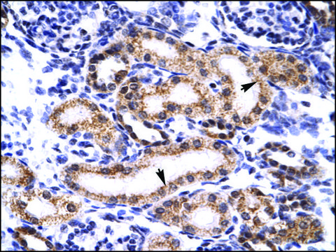 Anti-TRIM3 antibody produced in rabbit IgG fraction of antiserum