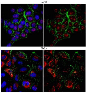 Anti-RAD51 Antibody from rabbit, purified by affinity chromatography