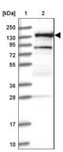 Anti-RNF40 antibody produced in rabbit Prestige Antibodies® Powered by Atlas Antibodies, affinity isolated antibody, buffered aqueous glycerol solution