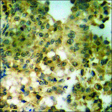 Anti-phospho-TOB1 (pSer164) antibody produced in rabbit affinity isolated antibody