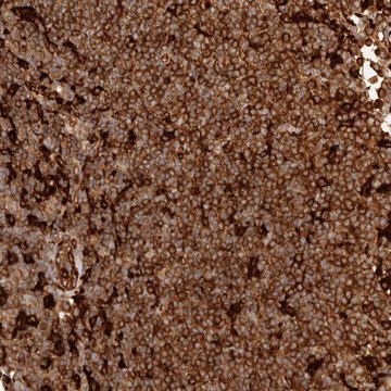 Anti-GBP5 antibody produced in rabbit Prestige Antibodies&#174; Powered by Atlas Antibodies, affinity isolated antibody, buffered aqueous glycerol solution