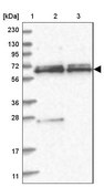 Anti-SPAG16 antibody produced in rabbit Prestige Antibodies® Powered by Atlas Antibodies, affinity isolated antibody, buffered aqueous glycerol solution
