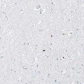Anti-MNDA antibody produced in rabbit Prestige Antibodies® Powered by Atlas Antibodies, affinity isolated antibody, buffered aqueous glycerol solution