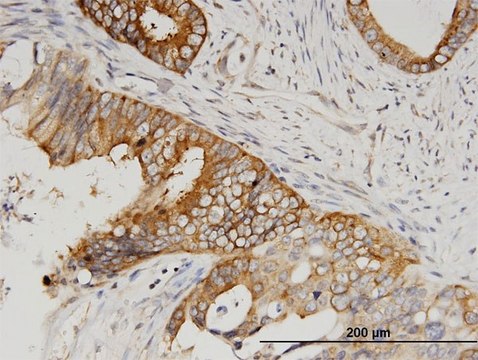 Monoclonal Anti-SERBP1 antibody produced in mouse clone 1G5-2D7, purified immunoglobulin, buffered aqueous solution