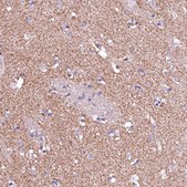 Anti-GPR176 antibody produced in rabbit Prestige Antibodies® Powered by Atlas Antibodies, affinity isolated antibody, buffered aqueous glycerol solution