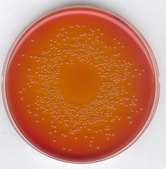 GranuCult® prime MacConkey (MAC) Agar according to ISO (21150, 21567, FDA-BAM ), according to EP, according to USP, according to JP