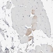 Anti-P4HA2 antibody produced in rabbit Prestige Antibodies® Powered by Atlas Antibodies, affinity isolated antibody, buffered aqueous glycerol solution