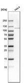 Anti-OGT antibody produced in rabbit Prestige Antibodies® Powered by Atlas Antibodies, affinity isolated antibody, buffered aqueous glycerol solution, ab1