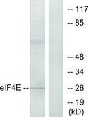 Anti-EIF4E antibody produced in rabbit affinity isolated antibody