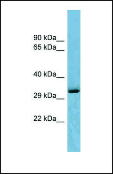 Anti-OTUD6B antibody produced in rabbit affinity isolated antibody