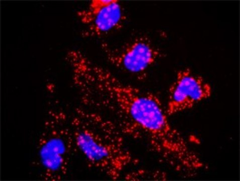 Anti-TBL1X antibody produced in rabbit purified immunoglobulin, buffered aqueous solution