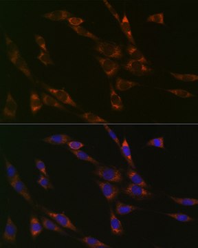 Anti-RPS3 Antibody, clone 3X2M4, Rabbit Monoclonal