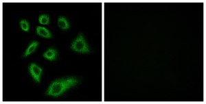 Anti-Cytochrome P450 2W1 antibody produced in rabbit affinity isolated antibody