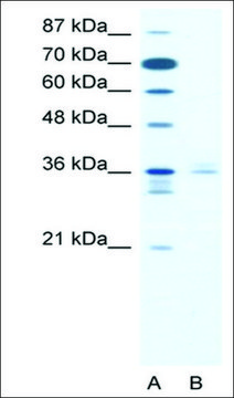 Anti-LHX3 (AB1) antibody produced in rabbit affinity isolated antibody