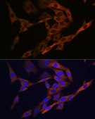 Anti-AGR2 antibody produced in rabbit